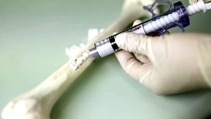single-video-image